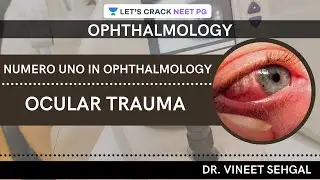 Numero Uno in Ophthalmology: Ocular Trauma | NEET-PG 2021 | Vineet Sehgal