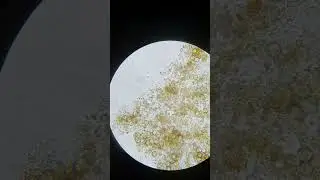nematodes under the microscope