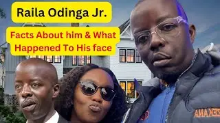 Inside Raila Odinga Jr.'s Life: Business, Family, Health Scare  &Why His Face Is Unbalanced