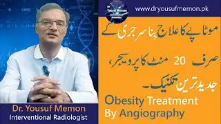 Obesity Treatment By Angiography | Bariatric Embolization | Motape Ka Bagair Surgery Ilaj