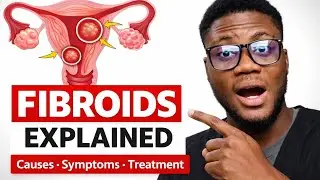 Fibroids Explained Simply: Causes, Symptoms, Risk Factors & Treatment Options for Women