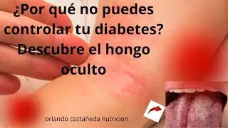 &iquest;Por qu&eacute; no puedes controlar tu diabetes? Descubre el hongo oculto