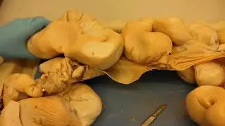 Pig urinary and reproductive systems dissection.