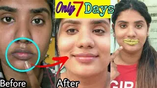 I followed🔥7 Days Challenge!!🔥How To Lighten Dark Lips Naturally At Home/100% Result/No side effects