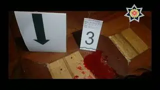 &iquest;Qu&eacute; es la inspecci&oacute;n ocular?