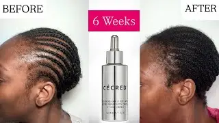 Cécred Restoring Hair & Edge Drops Review - Before & After 6 Weeks