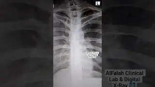 Portable Digital X-Ray 🩻 #alfalah #anatomy #digitalxray #doctor