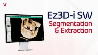Ez3D-i SW | Segmentation & Extraction