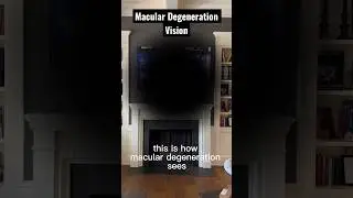 This is what Macular Degeneration does to your vision