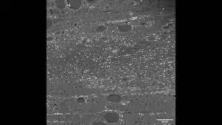 SBF-SEM Cross Sections