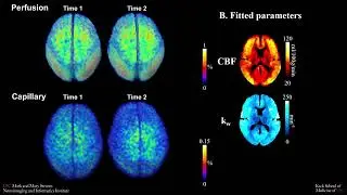 Tracking arterial blood as it moves through the brain's capillaries