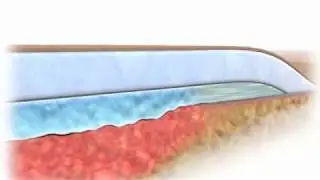 AQUACEL Foam - Mode of action