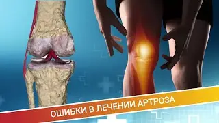 ОШИБКИ В ЛЕЧЕНИИ АРТРОЗА (История пациента)