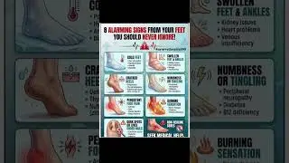 🚨8 Alarming Signs From Your Feet You Should NEVER Ignore 😱#shorts