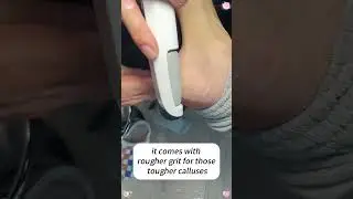 Achieve Smooth Feet Effortlessly with Tough Callus Solution