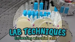 Microbial Enumeration: Counting fungal cells (cfu/mL) @sciencetingss