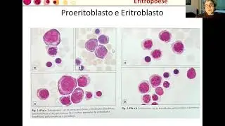 Aula contagem reticulocitos e eritroblastos
