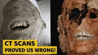 CT Scans Reveal the True Horror of Pompeii&rsquo;s BRUTAL Deaths