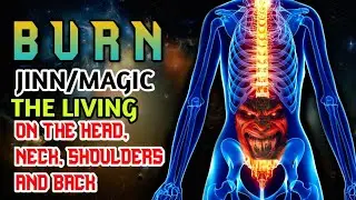 Relaxing Ruqyah Quran – Destroy Jinn, Sihr & Evil Spirits | Deep Healing Calm ALAA AQELL