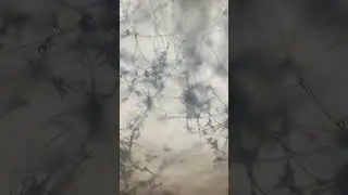 Плесень-гриб Candida albicans в микроскопе на микробиологии/fungus - mold under the microscope