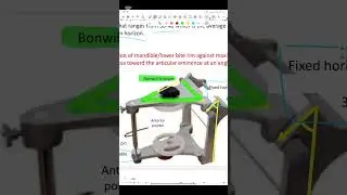 Prosthodontics lec 10 طب الاسنان مرحله ثانيه 