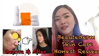BEAUTEDERM SKIN CARE REVIEW |ACNE PROBLEM SOLUTION IN A MONTH