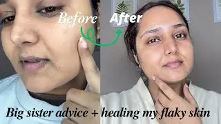 Big Sister Talk + Winter morning skincare routine for Dry and Healing seasonal skin shedding