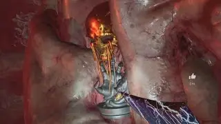 Back 4 Blood - All Secrets Trophy Guide - Ridden Hives