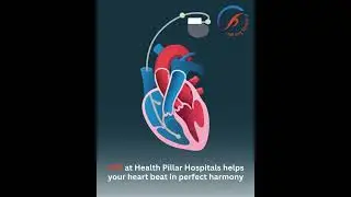 Random Heartbeat? Get Cardiac Resynchronisation Therapy (CRT) from Health Pillar Hospitals
