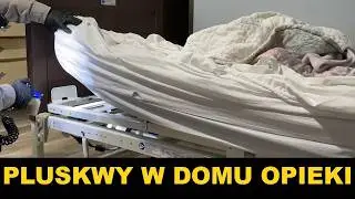 NIKT NIE SPODZIEWAŁ SIĘ TAM PLUSKIEW - jak pozbyć się pluskiew - pluskwa domowa  - spos&oacute;b na pluskwy