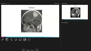 7/8/2025 Virtual OR Spine: Dr. Jonathan Rasouli