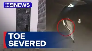 Man&rsquo;s toe partially cut off after tobacco heist turns into alleged kidnapping | 9 News Australia