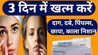 Pandrem++ Cream Use, Benefits, Side Effects In Hindi #panderm