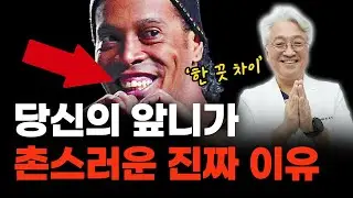 촌티 나는 인상, '앞니' 하나로 세련되게 바꾸는 법. 치료 후 변화..ㄷㄷ [인천치과, 미추홀구치]