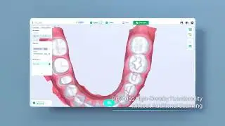 Lilivis SCAN - Complete the Perfect Same-Day Digital Workflow