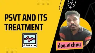PSVT and its treatment &lrm;| Dr Vishnu R Nair&nbsp;