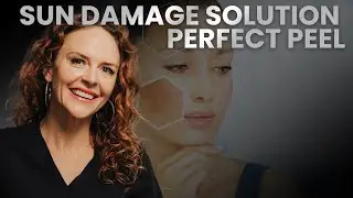 Sun Damage Solution: Perfect Peel Transformation! (Book Your Medspa Consult!)
