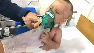 Critical Bronchiolitis Baby | Severe Distress Managed in NICU | Before & After Recovery