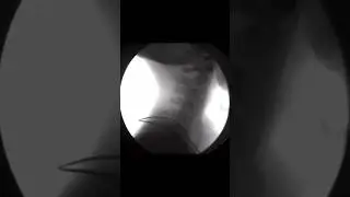 Neck mobility through X-Ray vision! #medical #science #neck