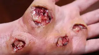SFX Tutorial  hand wound with pus - ferita alla mano