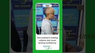 Chemo Wig For Cancer Patient in Mumbai |wigs for cancer patients near me |Hair Wigs |Cancer Wigs
