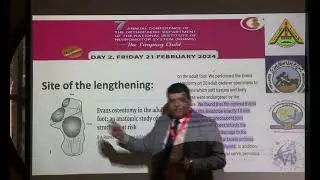 Day2 Workshop correction of pesplanovalgus feet & arthroereisis - Mahmoud Abouzeid