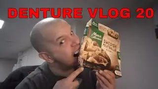 DENTURE VLOG 20 - 1ST RELINE/ BITE ADJUSTMENT ON DENTURE
