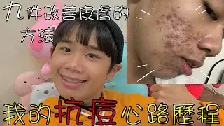 【Jumi啾咪】我的抗痘心路歷程｜九個改善皮膚方法分享 ｜抗痘過程心態上的調整