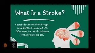 Stroke | Types Of stroke | Treatment | Hindi  #education #knowledge #science 