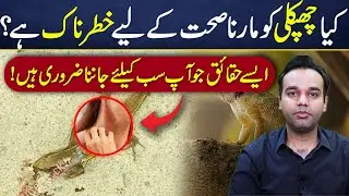 Does Killing a Lizard Cause Disease? Dr. Ali Raza Explains the Truth