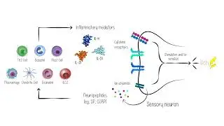 Itch & Nodule Formation in Prurigo Nodularis: Roles of Neuronal Dysregulation & Type 2 Inflammation