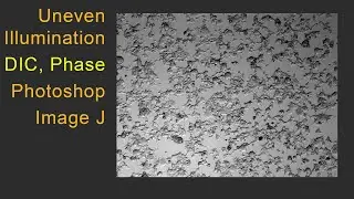 Uneven Illumination Phase DIC TEM