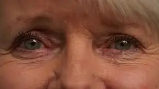 Eyes Stock Video