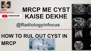 MRCP ME CYST KAISE DEKHE| HOW TO RULE OUT CYST IN MRCP SCAN #mrcp